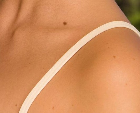 Cost Of Skin Tag Removal Information